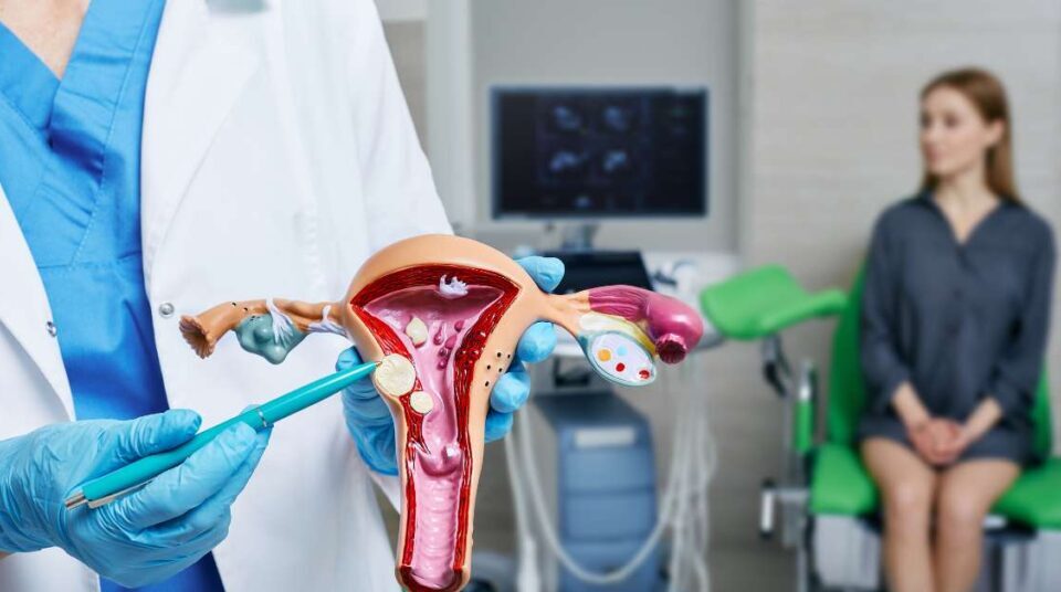 O que é Mioma Uterino?